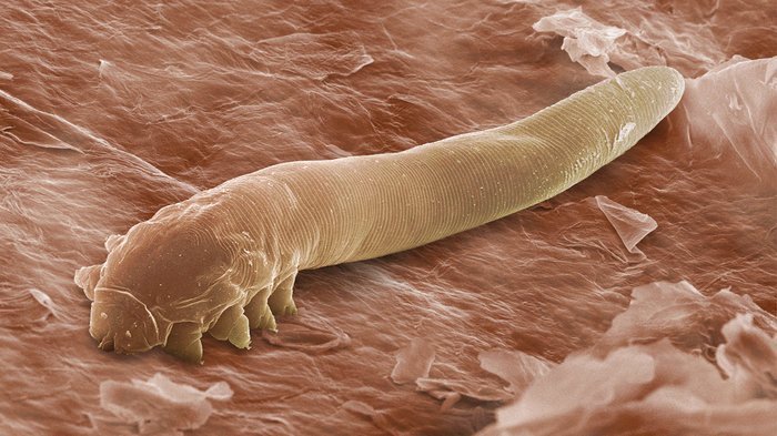 Parásitos en tu organismo, síntomas y el método para combatirlos de manera natural